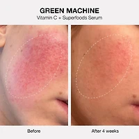 The Healthy Skin Edit Bestsellers Kit