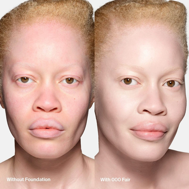 Triclone Skin Tech Medium Coverage Foundation with Fermented Arnica