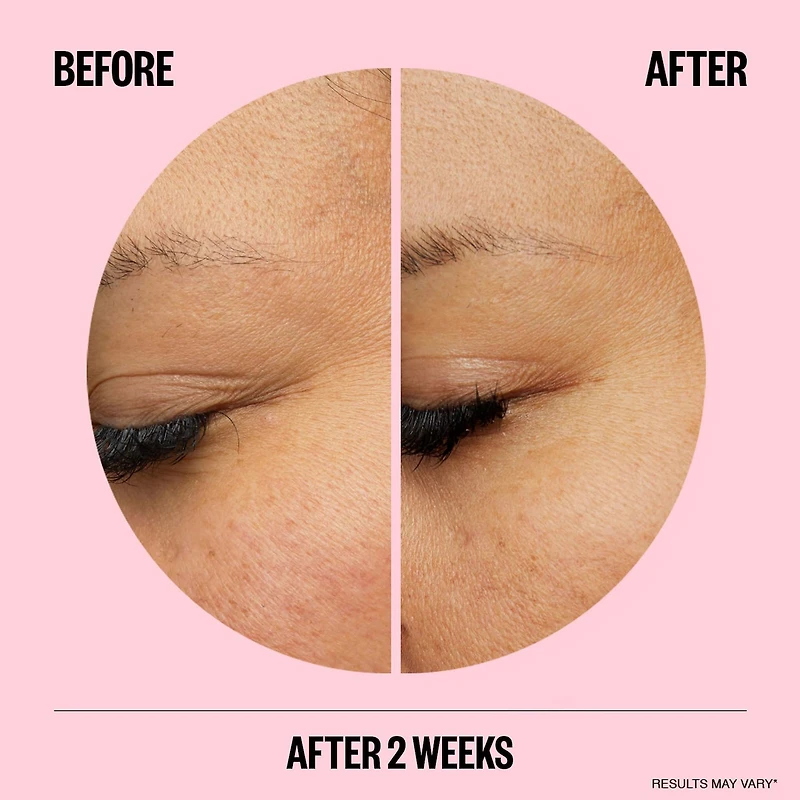 Microneedling Anti-Wrinkle Retinol Patches
