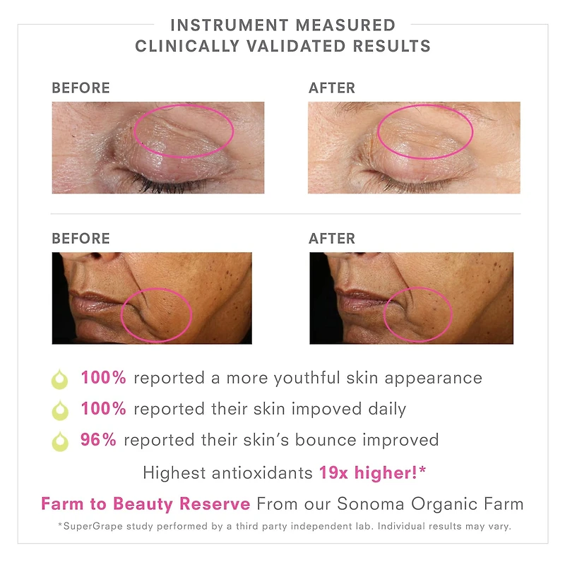 Stem Cellular SUPERGRAPE Youth Renew Serum