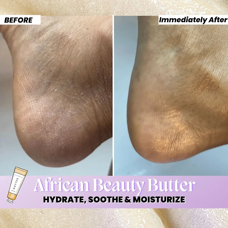 AFRICAN Beauty Butter- Intensive Dry Skin Treatment