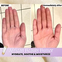 AFRICAN Beauty Butter- Intensive Dry Skin Treatment