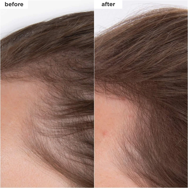 Sérum aux peptides Destined for Density™ pour des cheveux plus épais et plus volumineux