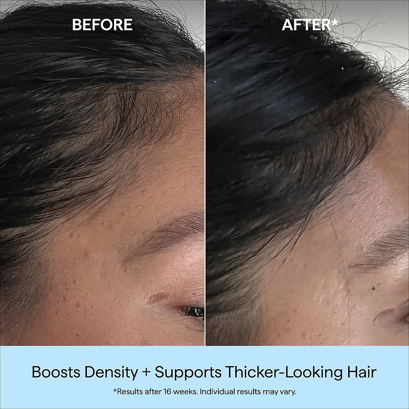 Destined for Density™ Peptide Hair Serum for Thicker, Fuller Hair