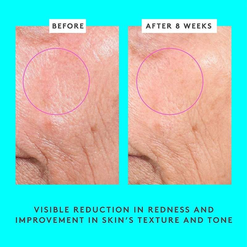 Masque illuminateur Bouncy Brightfacial avec 10 % d’acide azélaïque + 1 % d’acide salicylique