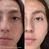 Pore Minimizing Volcanic Sea Clay Detox Mask For Dullness & Dryness