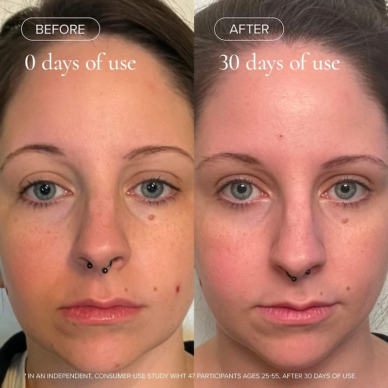 Sea Vitamin C Serum for Brightening Dark Spots & Redness with Algae