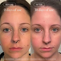 Sea Vitamin C Serum for Brightening Dark Spots & Redness with Algae