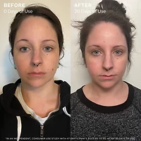 Sea Vitamin C Serum for Brightening Dark Spots & Redness with Algae