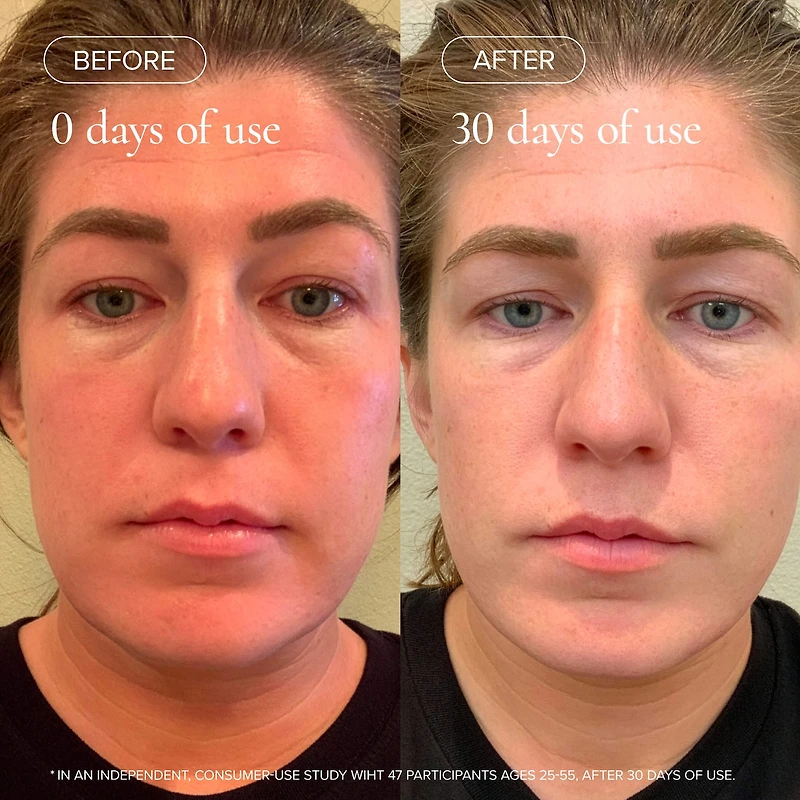 Sea Vitamin C Serum for Brightening Dark Spots & Redness with Algae