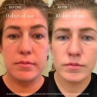 Sea Vitamin C Serum for Brightening Dark Spots & Redness with Algae