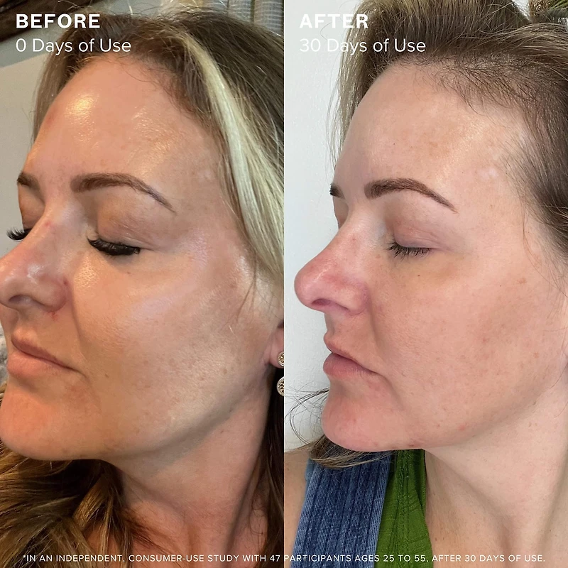 Sea Vitamin C Serum for Brightening Dark Spots & Redness with Algae
