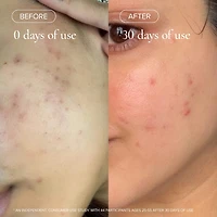 Mini 1.2% Clean Algae Retinol Face Oil for Anti-Aging and Wrinkles with Green Tea