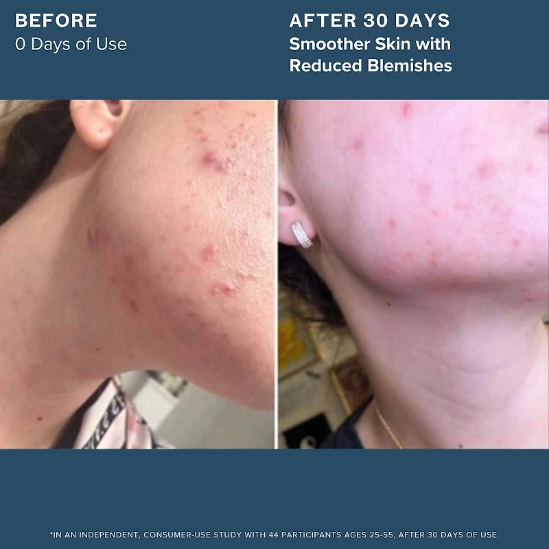 Mini 1.2% Clean Algae Retinol Face Oil for Anti-Aging and Wrinkles with Green Tea