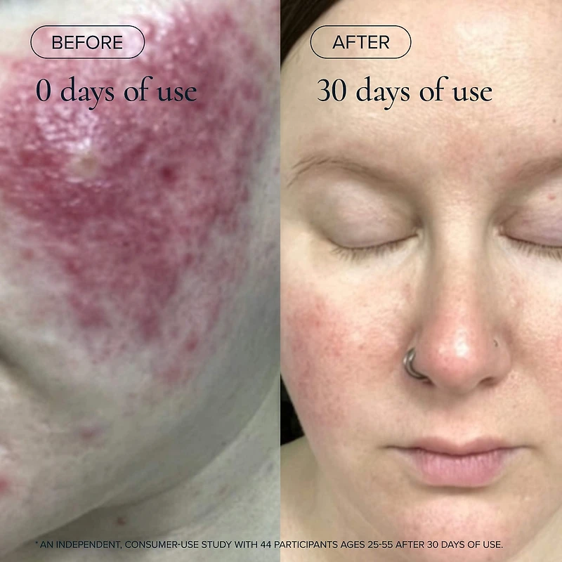 Mini 1.2% Clean Algae Retinol Face Oil for Anti-Aging and Wrinkles with Green Tea