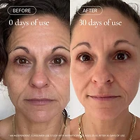 Mini 1.2% Clean Algae Retinol Face Oil for Anti-Aging and Wrinkles with Green Tea
