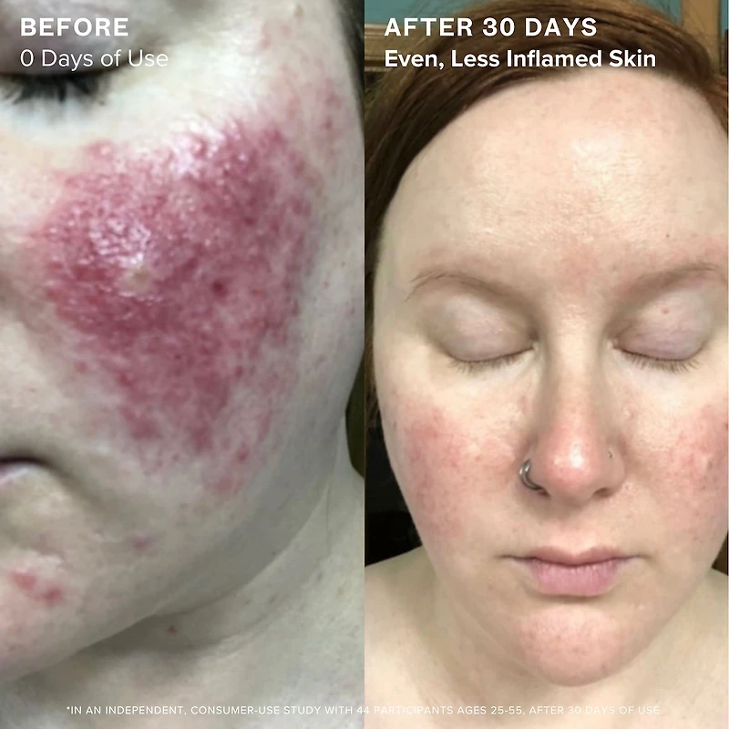 1.2% Clean Algae Retinol Face Oil for Anti-Aging and Wrinkles with Green Tea