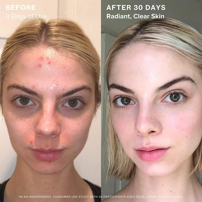 1.2% Clean Algae Retinol Face Oil for Anti-Aging and Wrinkles with Green Tea