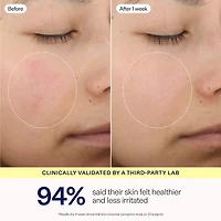 barrier+ Triple Lipid Activating Serum With Plumping Peptides and Niacinamide