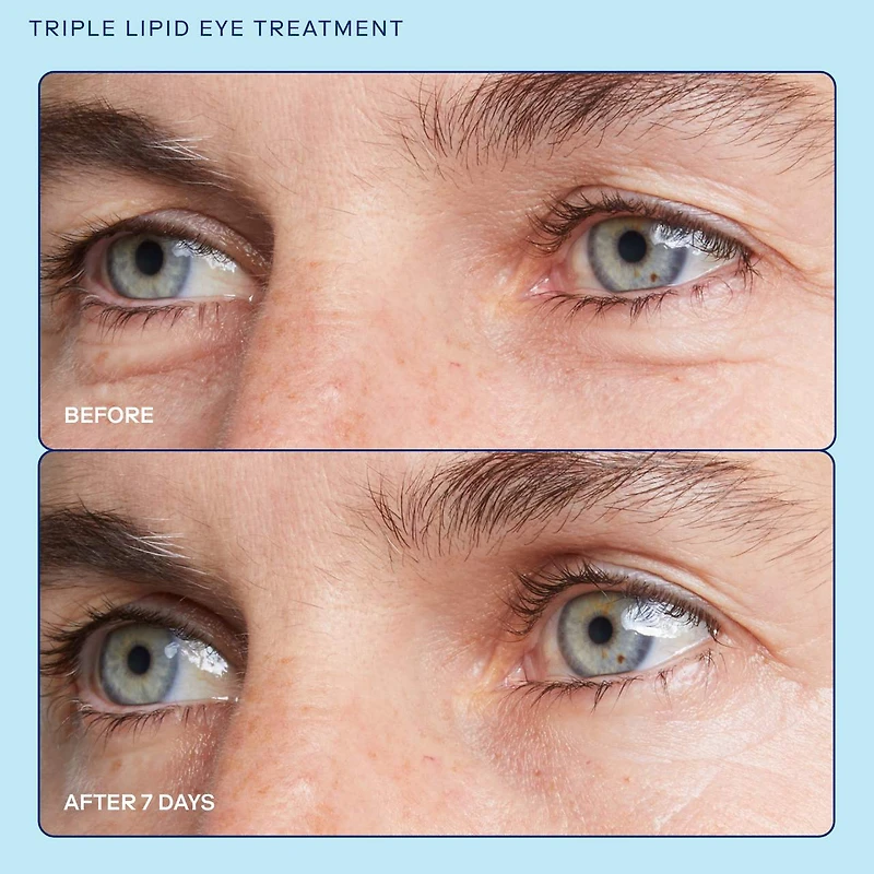 Crème contour des yeux illuminante Triple Lipid barrier+