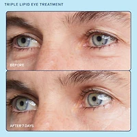 Crème contour des yeux illuminante Triple Lipid barrier+