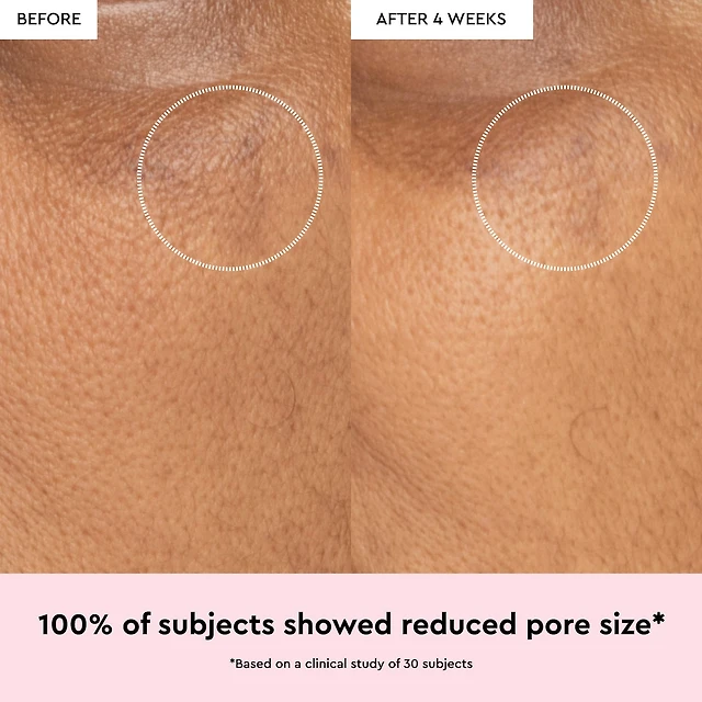 Watermelon Glow Niacinamide Dew Drops Serum