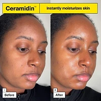 Crème hydratante Ceramididin™ pour la barrière cutanée