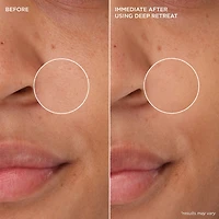 Masque à l’argile kaolin pour nettoyer les pores Deep Retreat The POREfessional