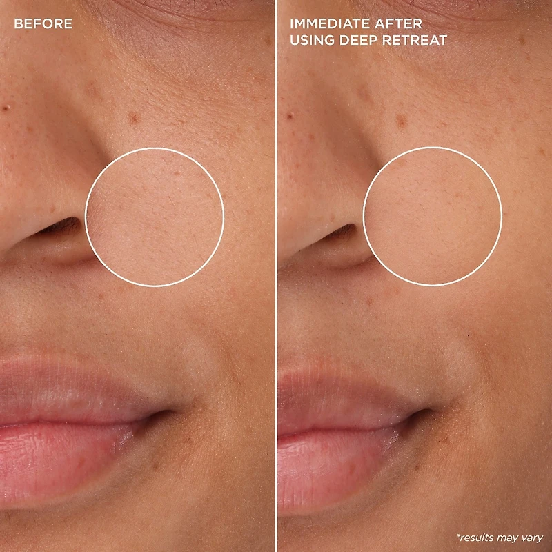 Minimasque à l'argile pour nettoyer les pores Deep Retreat The POREfessional