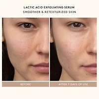 Tout commence par le rétinol : Ensemble de départ de Shani 	