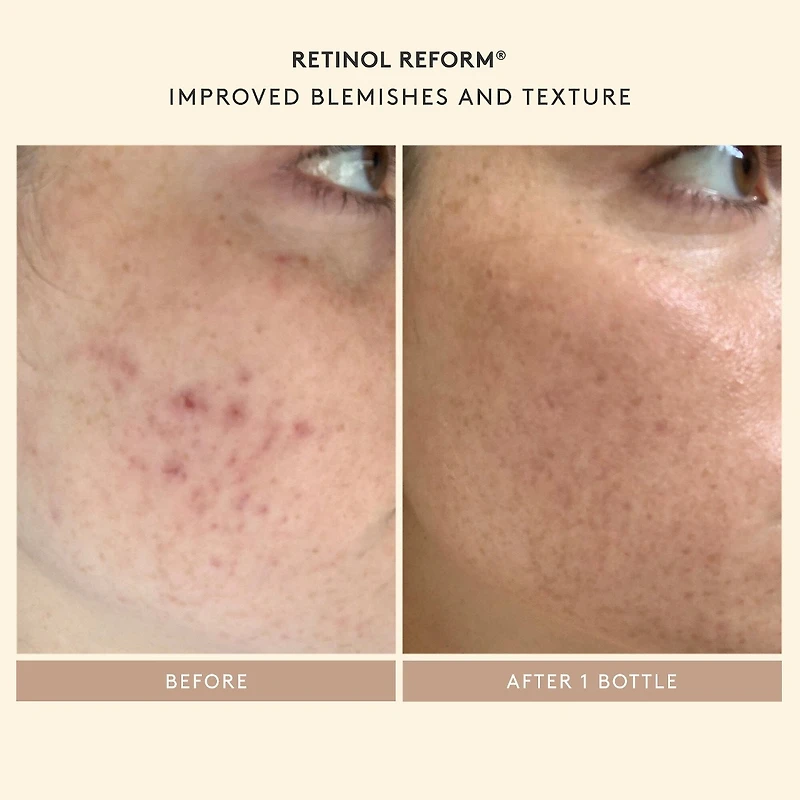 Tout commence par le rétinol : Ensemble de départ de Shani