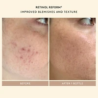 Tout commence par le rétinol : Ensemble de départ de Shani 	