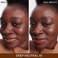 Anticernes et sérum Bye Bye Dark Spots avec niacinamide acide hyaluronique