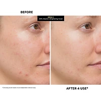 MEGA-C™ 30% Vitamin C Brightening Mask