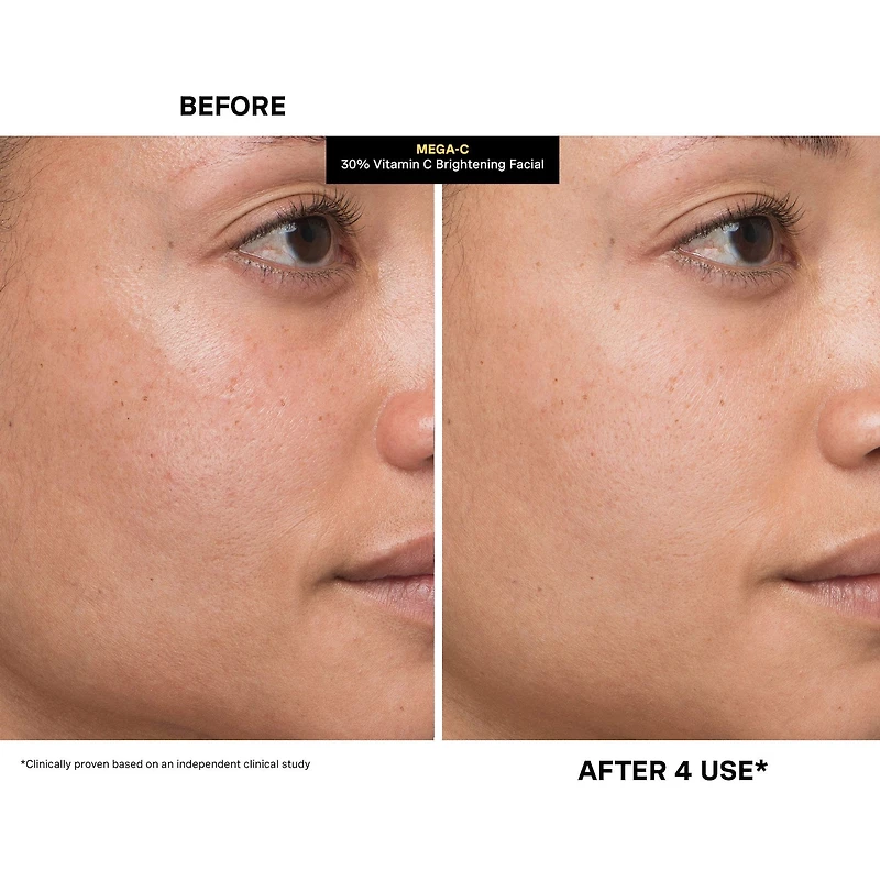 MEGA-C™ 30% Vitamin C Brightening Mask