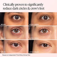 Bright & Tight Dark Circle Firming Eye Cream with Vitamin C & Peptides