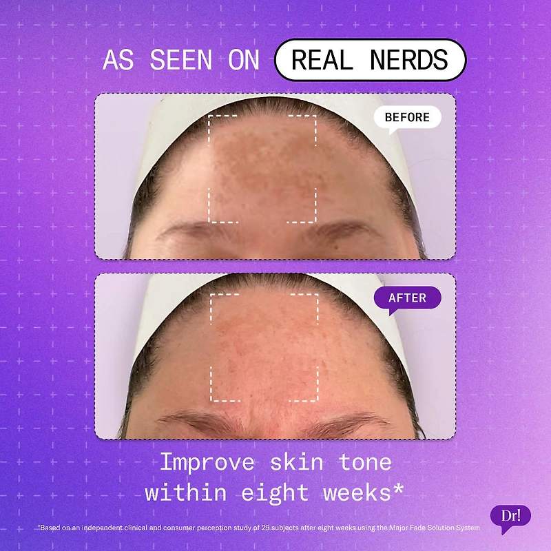 Major Fade Hyper Serum Dark Spot + Hyperpigmentation Treatment with Niacinamide and Glycerin