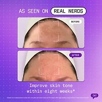 Major Fade Hyper Serum Dark Spot + Hyperpigmentation Treatment with Niacinamide and Glycerin