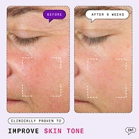 Major Fade Hyper Serum Dark Spot Treatment