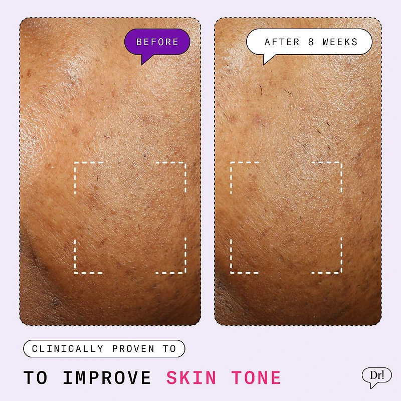 Major Fade Active Seal Dark Spot Vitamin C Gel Moisturizer