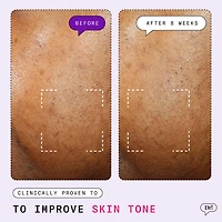 Major Fade Active Seal Dark Spot Vitamin C Gel Moisturizer