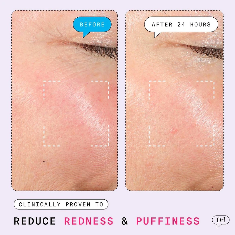 The Depuffer Redness Reducing + Depuffing Roll-On Serum