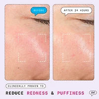 The Depuffer Redness Reducing + Depuffing Roll-On Serum