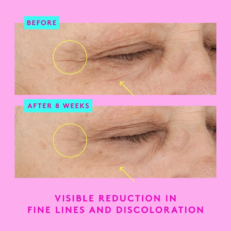 Sérum contour des yeux au rétinol A-Shaba Complex avec caféine et peptides de cuivre