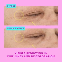Sérum contour des yeux au rétinol A-Shaba Complex avec caféine et peptides de cuivre