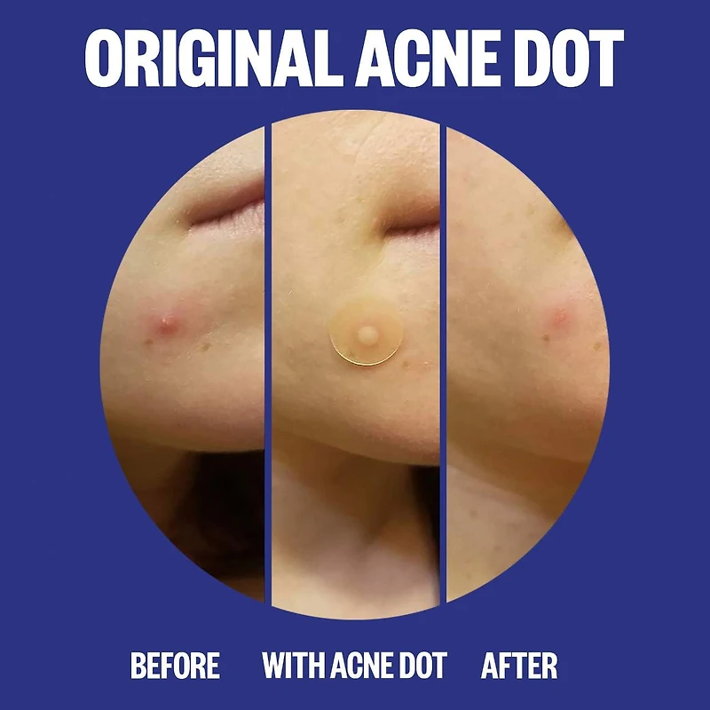 Acne Salicylic Acid Day & Night Duo