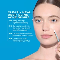 Soin anti-acné Deep relief avec acide salicylique