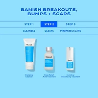 Soin anti-acné Deep relief avec acide salicylique