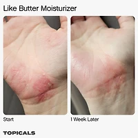 Like Butter Moisturizer for Dry, Sensitive & Eczema-Prone Skin