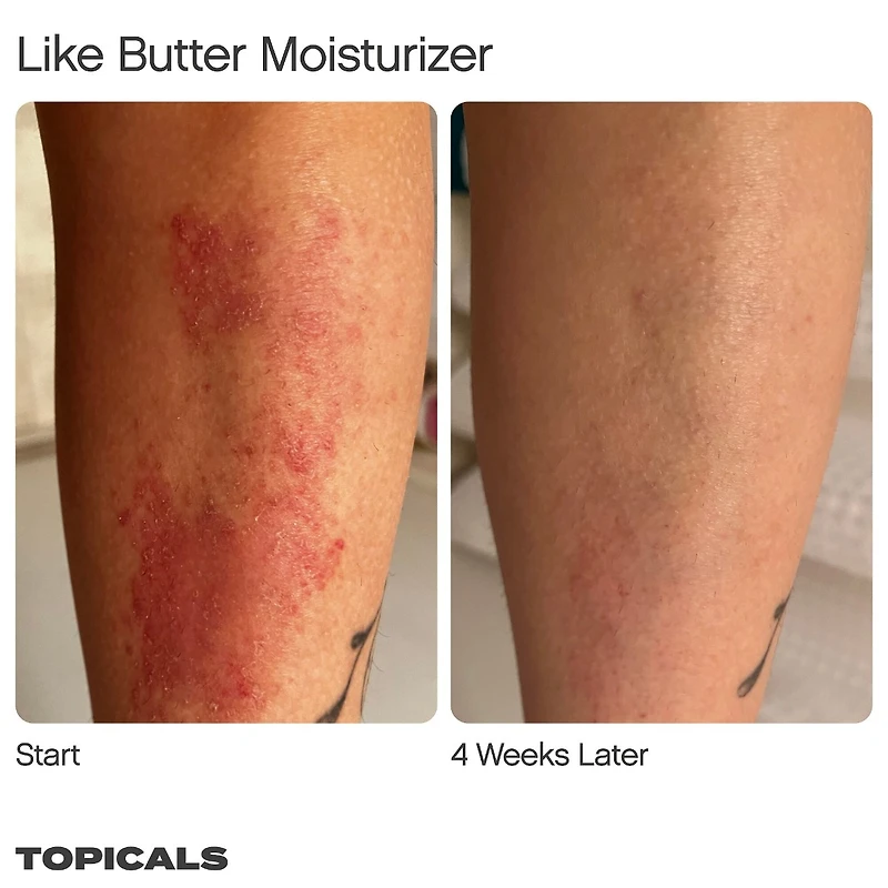 Like Butter Moisturizer for Dry, Sensitive & Eczema-Prone Skin